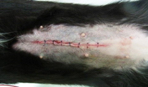 開腹による避妊