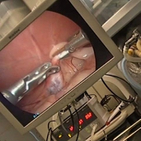 腹腔鏡による避妊手術