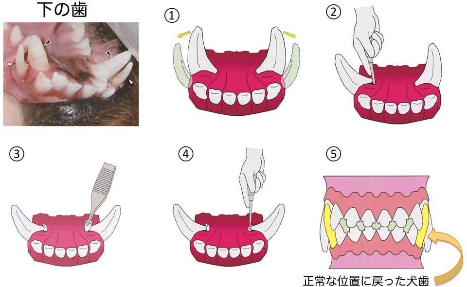 歯科、口腔内予防処置