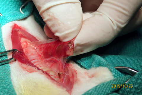 大きくなった甲状腺